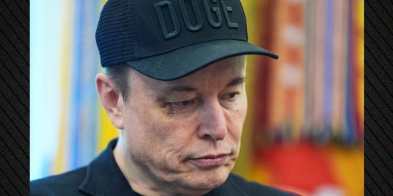Elon Musk Me Sy Të Mavijosur Në Zyrën E Trump – Reagime Dhe Dyshime Pas Lamtumirës Nga Qeveria
