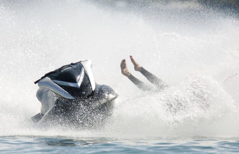Turisti Belg Në Gjendje Të Rëndë Pas Aksidentit Me Jet Ski Në Durrës – Policia Shoqëron Pronarin E Mjetit