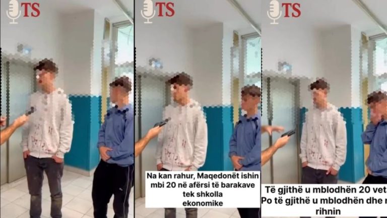 Nacionalistët maqedonas rrahin barbarisht dy të mitur shqiptar në Tetovë