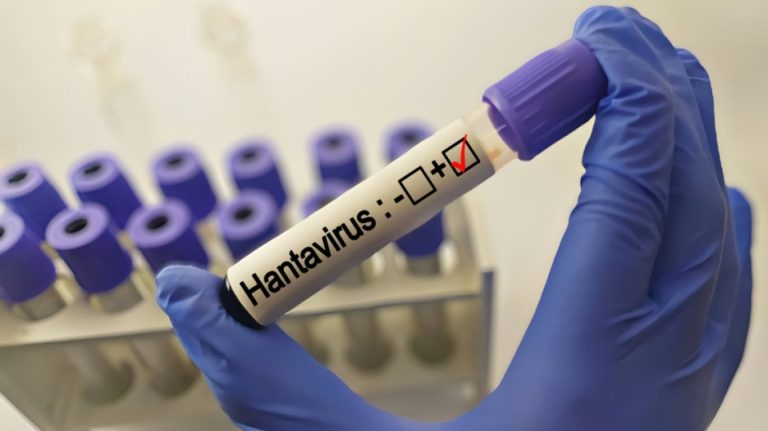 OBSH paralajmëron rritje të rasteve me hantavirus në javët e ardhshme