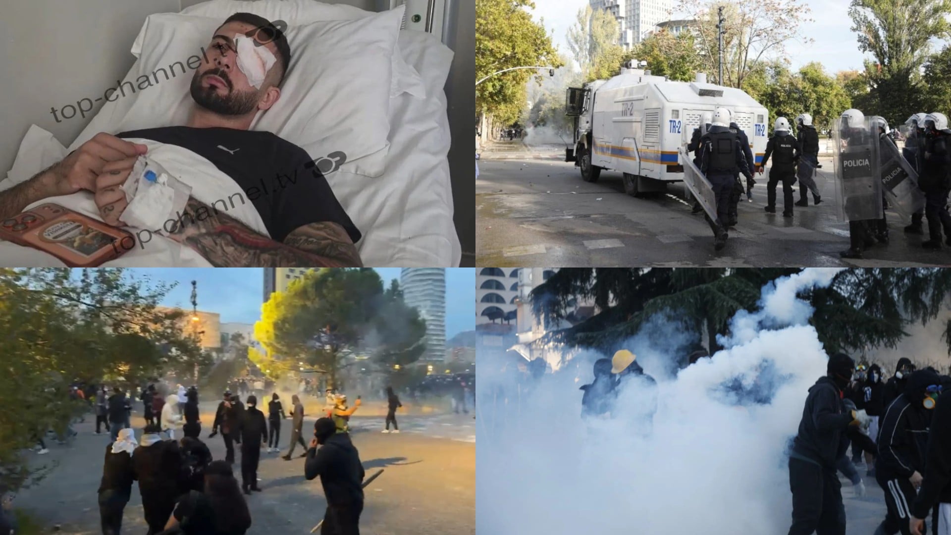 Prokuroria heton policinë pas plagosjes së Erjon Vishkullit në protestë, sekuestrohen kamerat