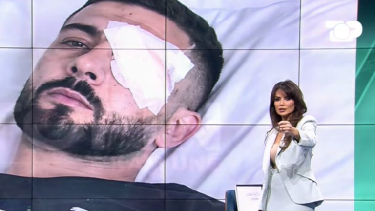 Erjon Vishkulli pritet të operohet në Itali pas plagosjes në sy gjatë protestës
